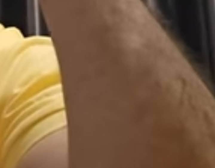 إصابة هشام جيراندو بمرض "الفيتيليغو" نتيجة الظروف الصعبة التي يمر بها 3 IMG 20250328 WA0116