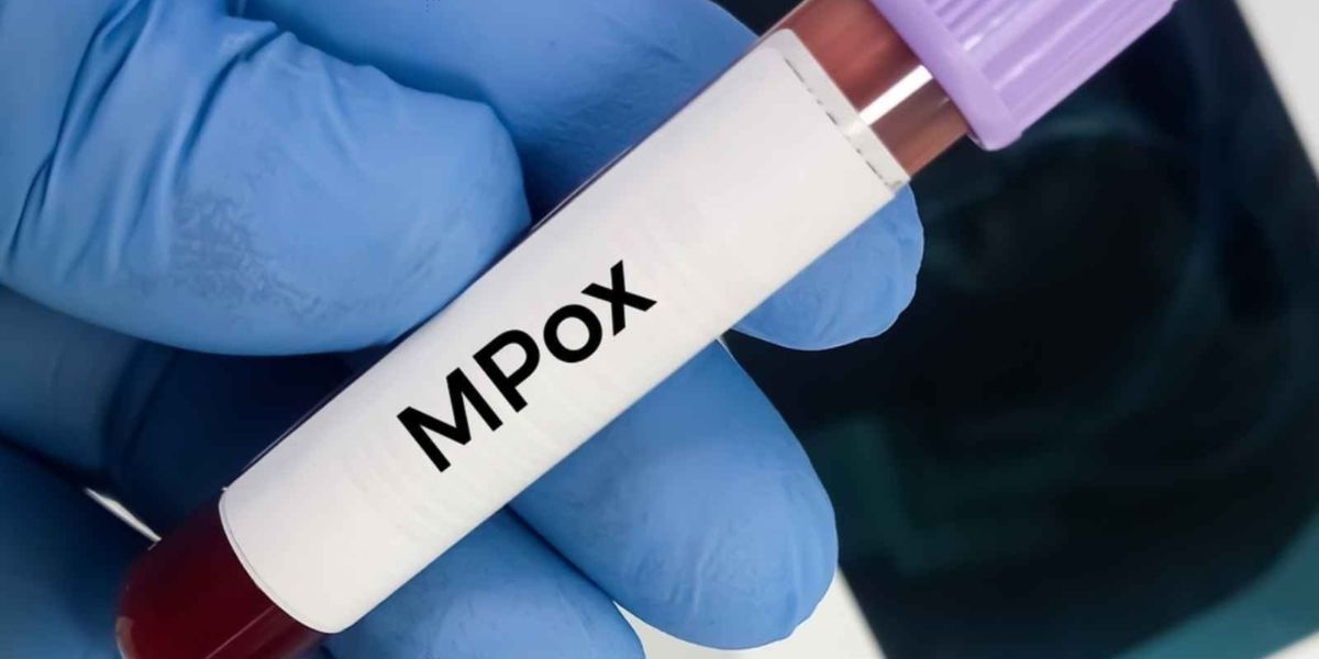 Variole du singe Mpox 1 2