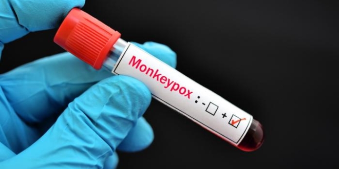 214 110818 monkeypox continues threaten who emergency 700x400